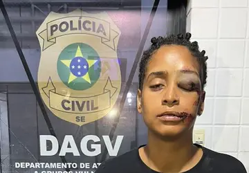 Mulher tem rosto desfigurado durante confusão em lanchonete em Aracaju e denuncia homofobia